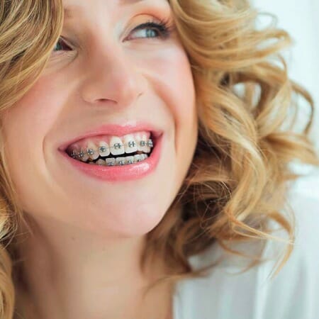 Mujer con ortodoncia