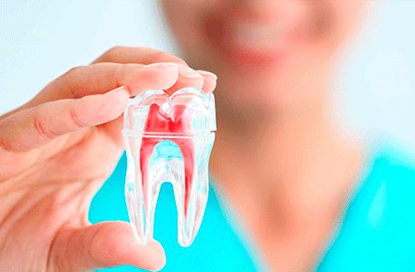 Endodoncia