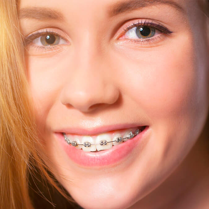 Usuaria brackets de zafiro