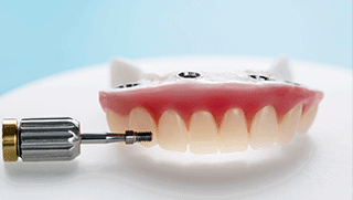 Puente dental